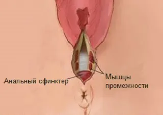 Промежность, как выглядят слезы диаграммы