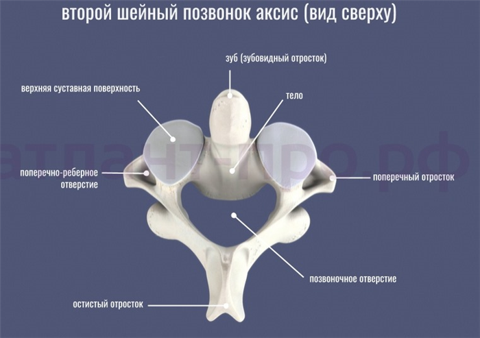 Аксис