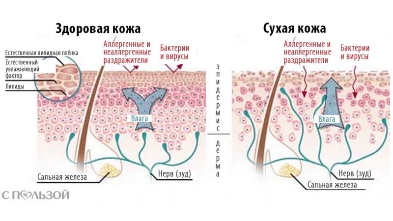 Разница между сухой и здоровой кожей