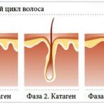 Стадии роста волос