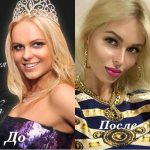 Ханна певица до пластики