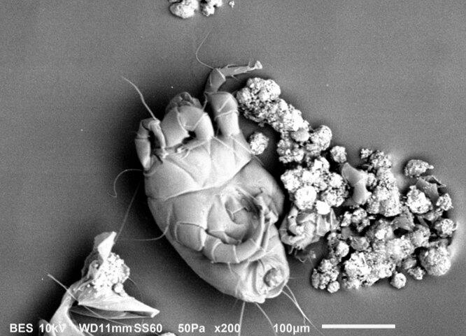 Пылевой клещ под электронным микроскопом